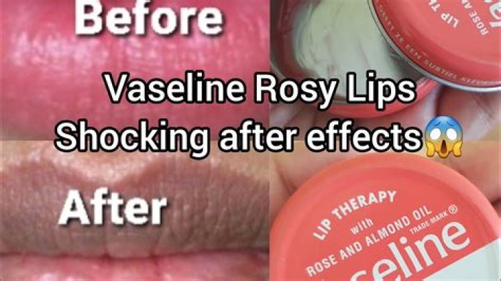 does vaseline darken lips